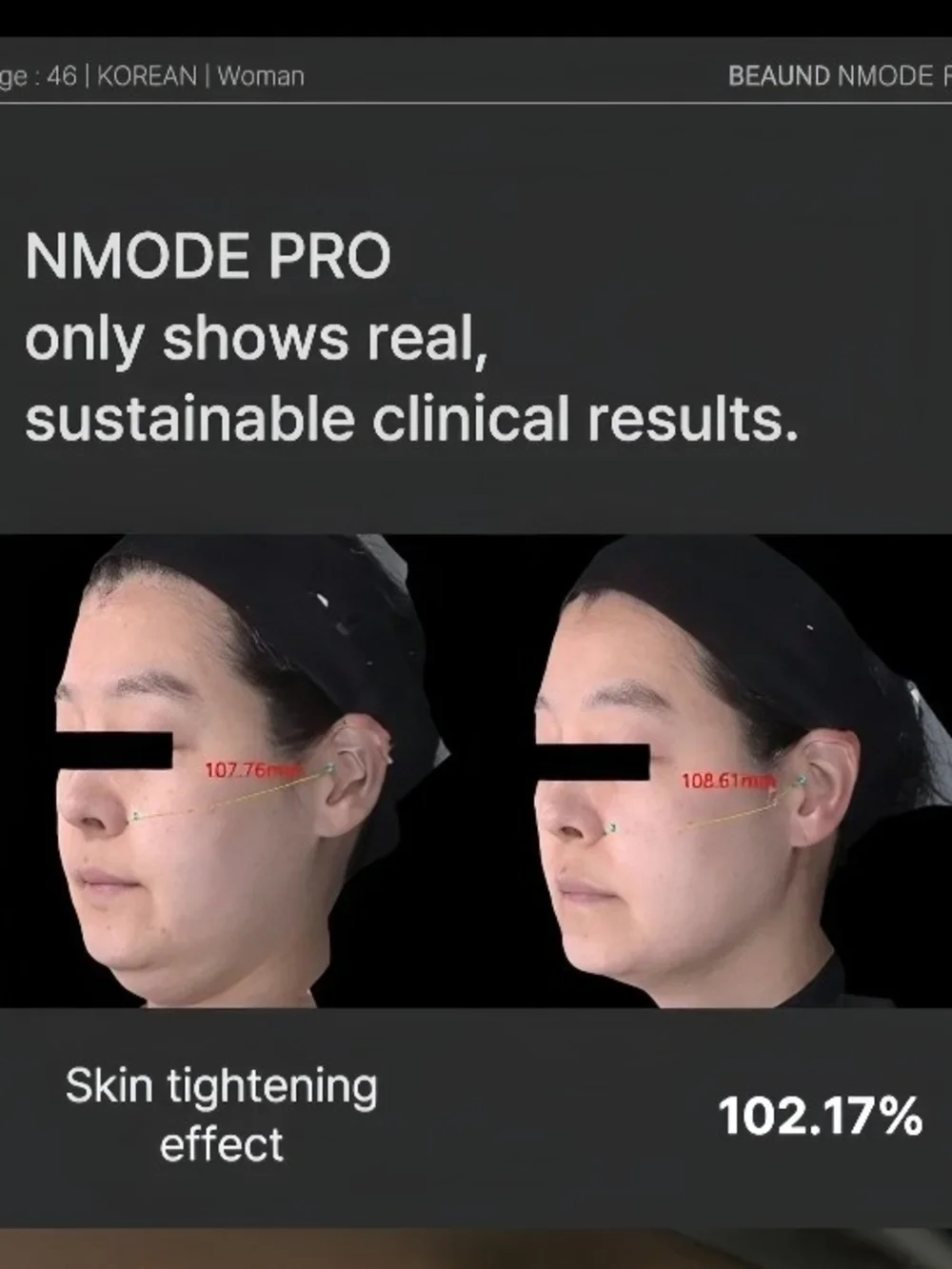Beaund - Nmode Pro Pink Edition